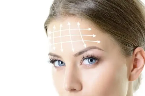 frontoplasty-e1635186396969-1